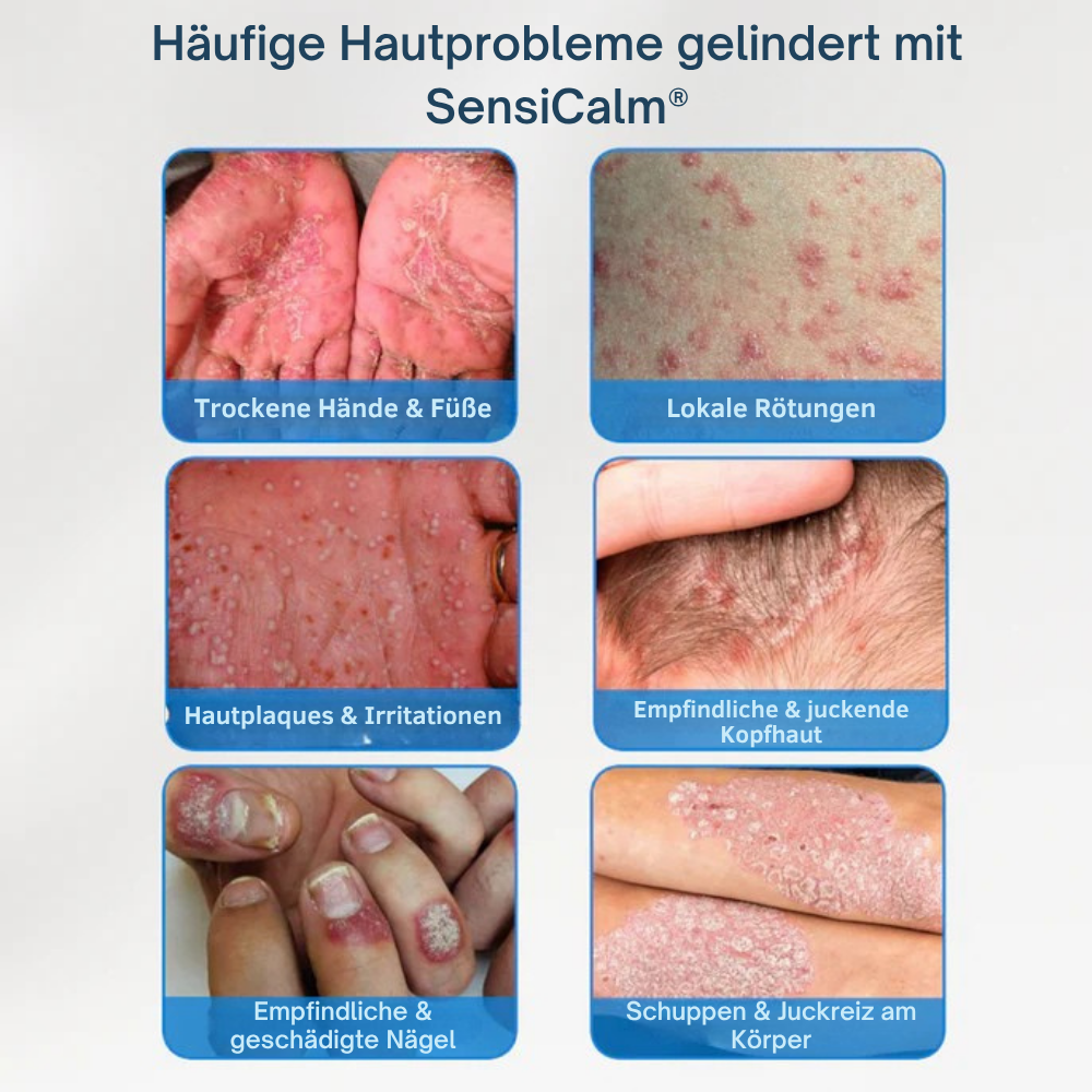 DermBalance® Creme ⎜ Für eine weiche und beruhigte Kopfhaut und Haut