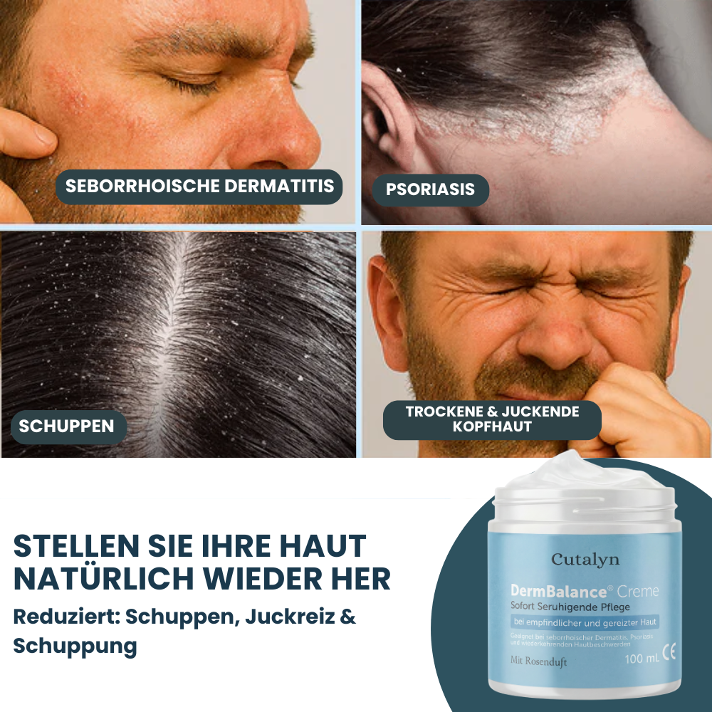 DermBalance® Creme ⎜ Für eine weiche und beruhigte Kopfhaut und Haut