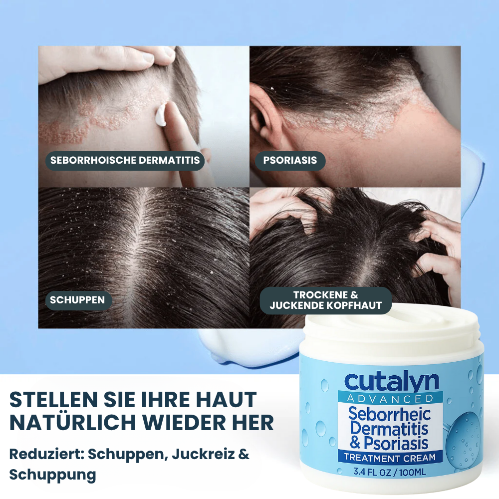 SensiCalm® Creme ⎜ Für eine saubere, gesunde und beruhigte Kopfhaut