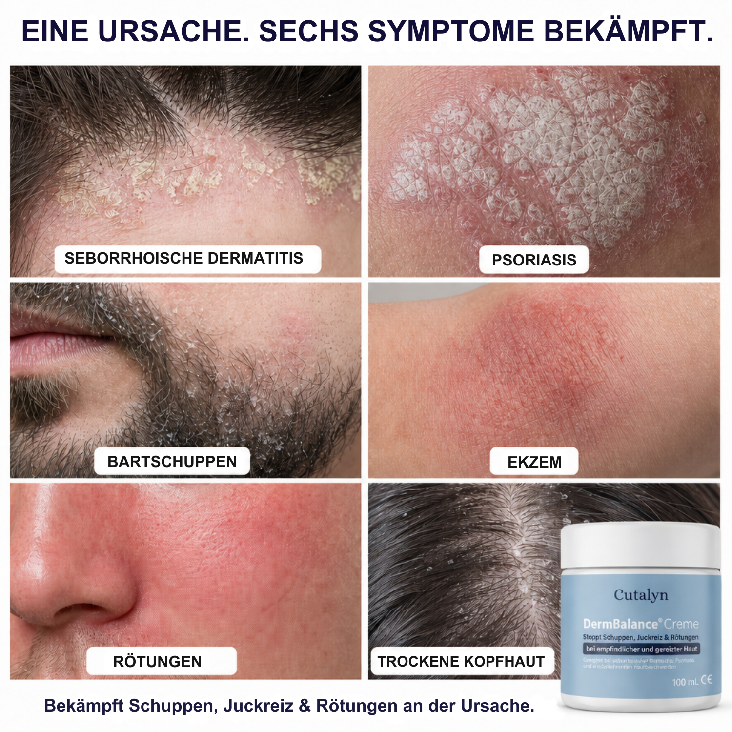 DermBalance® Creme